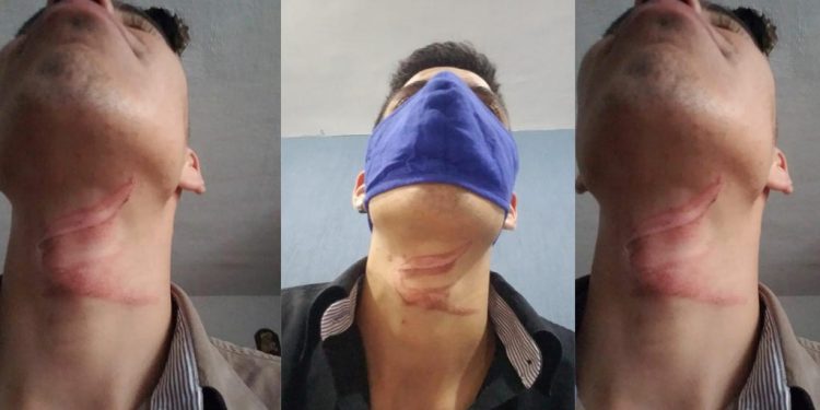 Cables colgando se han convertido en peligrosas trampas