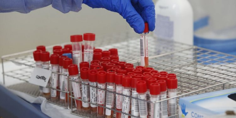 Tubos de pruebas PCR para la detección del covid