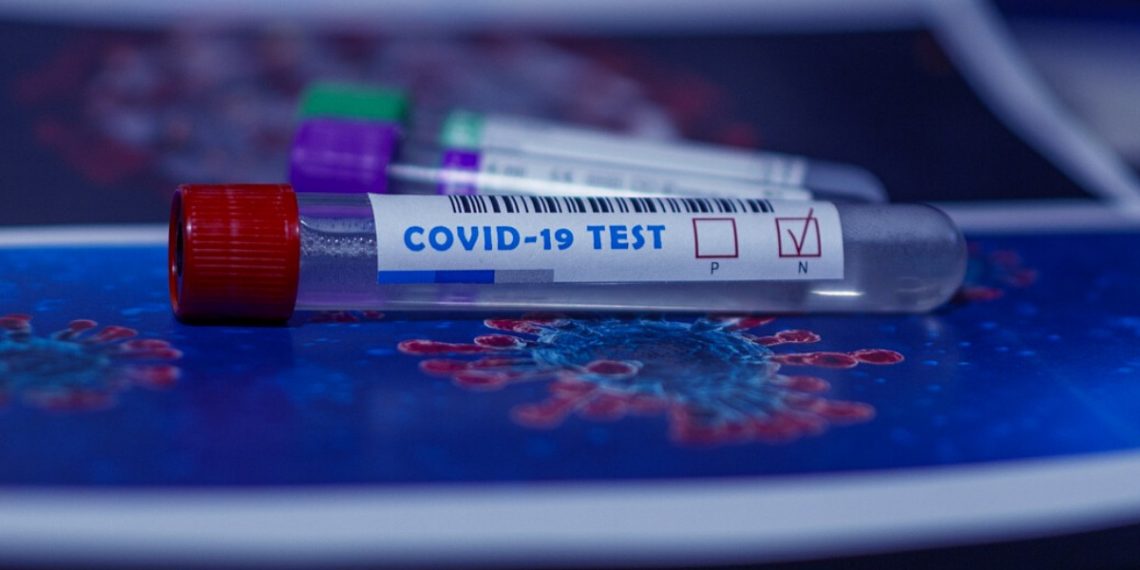 prueba de coronavirus