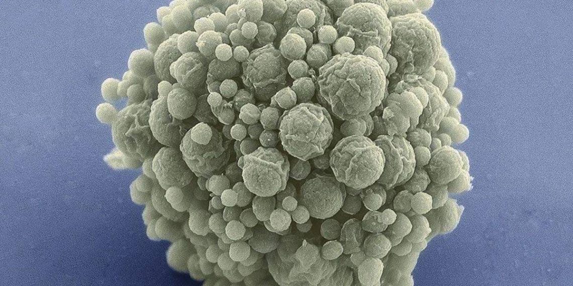 Foto: La célula sintética creada por el JCVI con 473 genes. (NCIMR)
