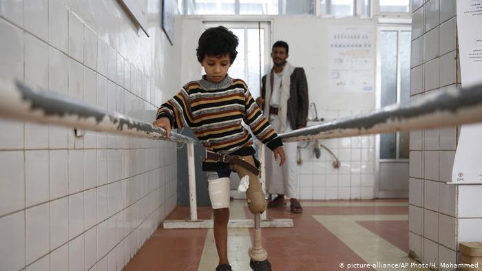 A young boy who lost his leg due to Yemen's conflict uses a prosthetic limb at a government-run rehabilitation center