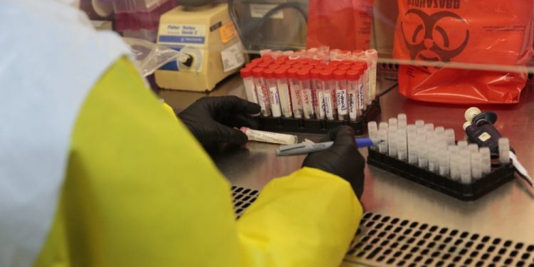 Salud anuncia la detección nueva variante del Covid-19 – Noticias Última Hora de Guatemala