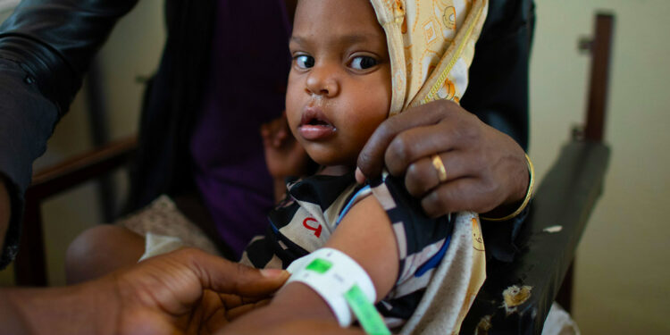 Niño en consulta por desnutrición en un centro de salud en Tigray, Etiopía.