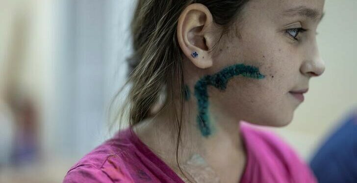 Foto del martes de Milana, una niña de 11 años que se recupera de las heridas en un hospital en Zaporizhzhia
Mar 29, 2022. REUTERS/Marko Djurica