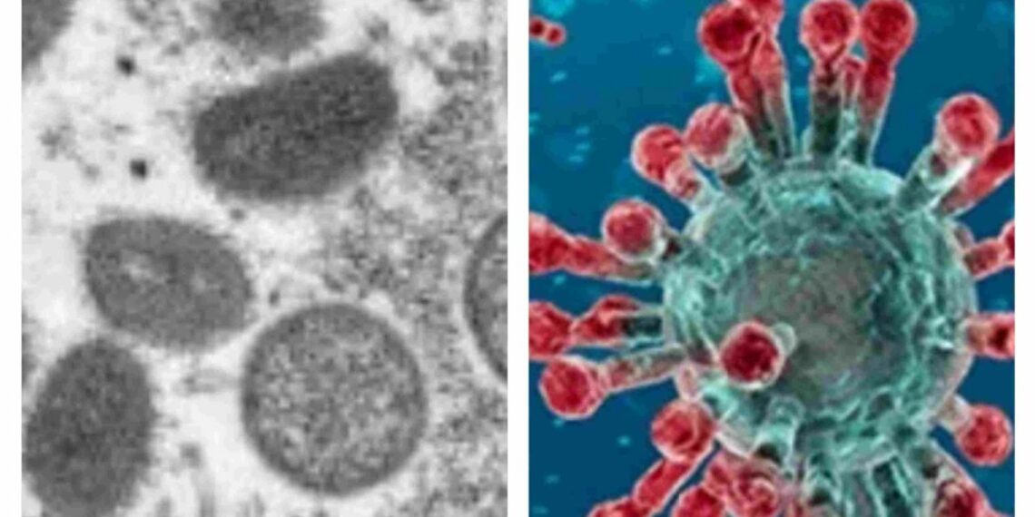 Viruela del mono y coronavirus: Semejanzas y diferencias de las enfermedades virales