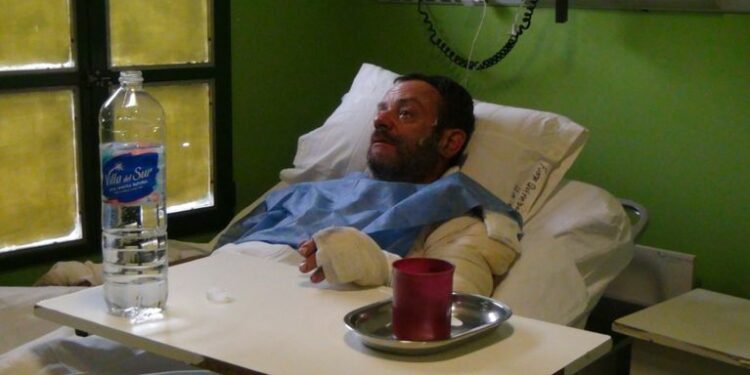 Pablo Conti se encuentra internado con quemaduras en el 20 % del cuerpo