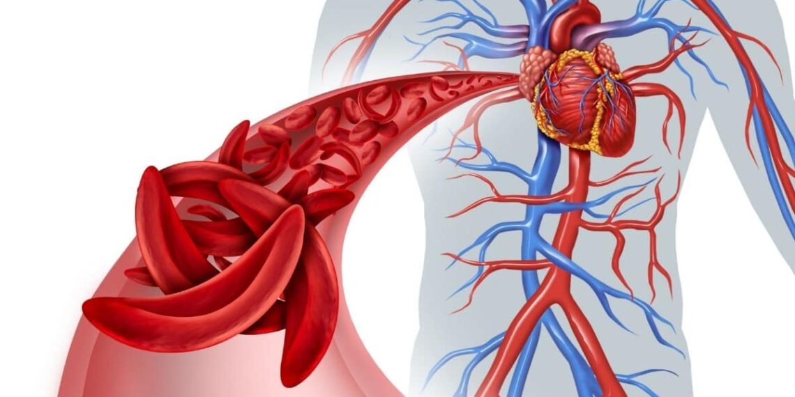 Cuida tu circulación mientras viajas con estos 5 simples ejercicios