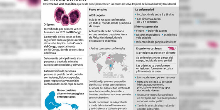 Todo lo que debes saber sobre la viruela del mono
