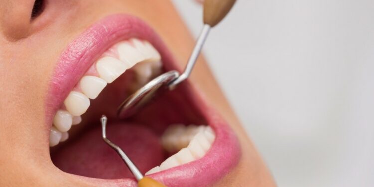 Así funciona el peligroso turismo dental en Turquía