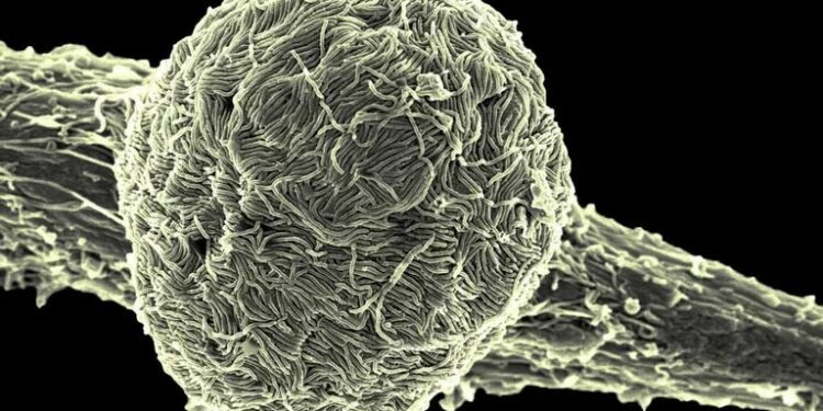 Uganda asegura que el país es un lugar seguro para viajar a pesar del brote de ébola