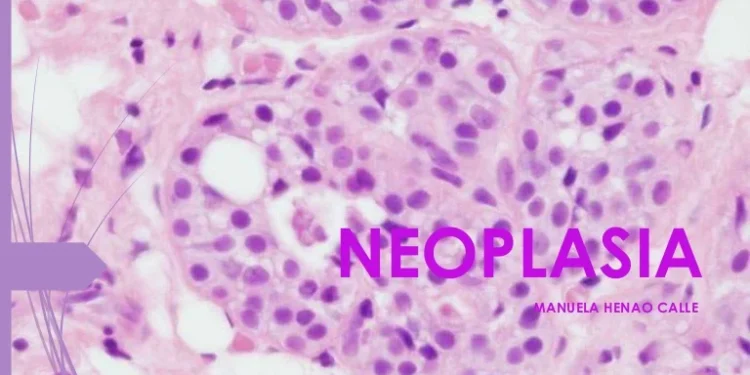 Es una neoplasia prevenible si se detecta y trata oportunamente