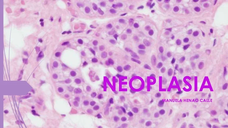 Es una neoplasia prevenible si se detecta y trata oportunamente