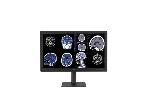 El nuevo monitor de diagnóstico LG con IPS Black ofrece una excelente en calidad de imagen
