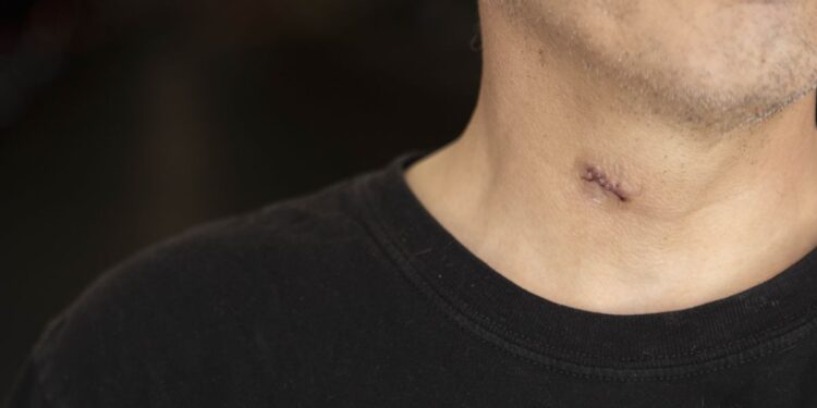 Conductor apuñalado mientras hacía Uber en Dallas pide más seguridad