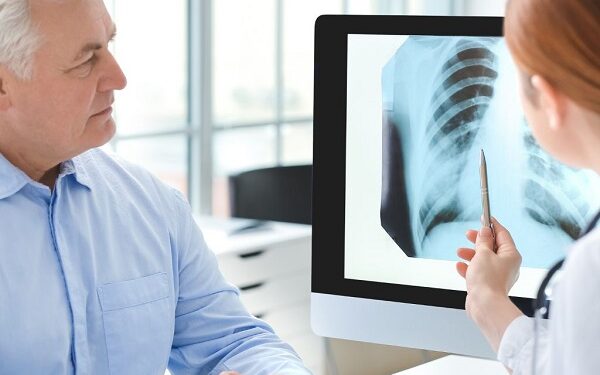 Fibrosis Pulmonar: Enfermedad respiratoria que roba el aliento