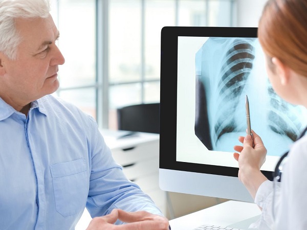 Fibrosis Pulmonar: Enfermedad respiratoria que roba el aliento