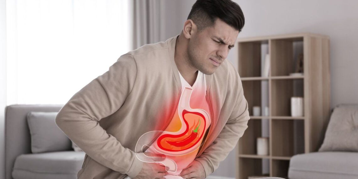 8 Foods To Avoid To Prevent Acid Reflux (Heartburn)