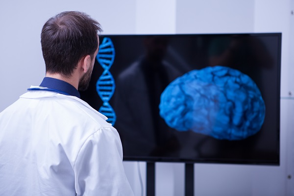 La enfermedad vascular cerebral es la séptima causa de decesos en México; puede prevenirse con cambios en estilo de vida y control de enfermedades crónicas