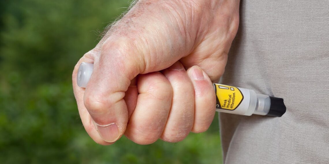 Food allergies, symptoms, treatment, what to do anaphylaxis