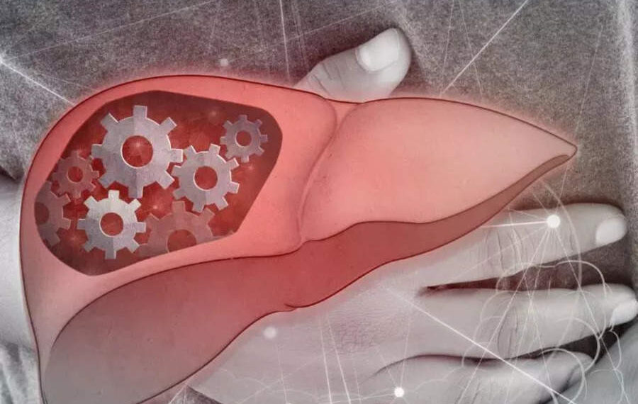 ​11 foods to consume to treat fatty liver