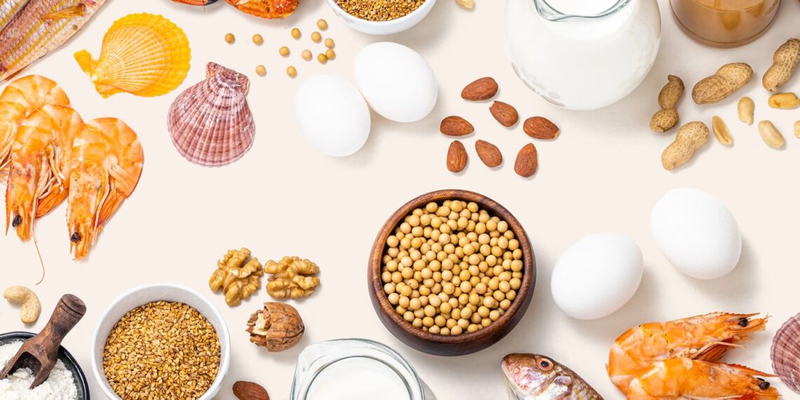 Food Allergies and Eczema