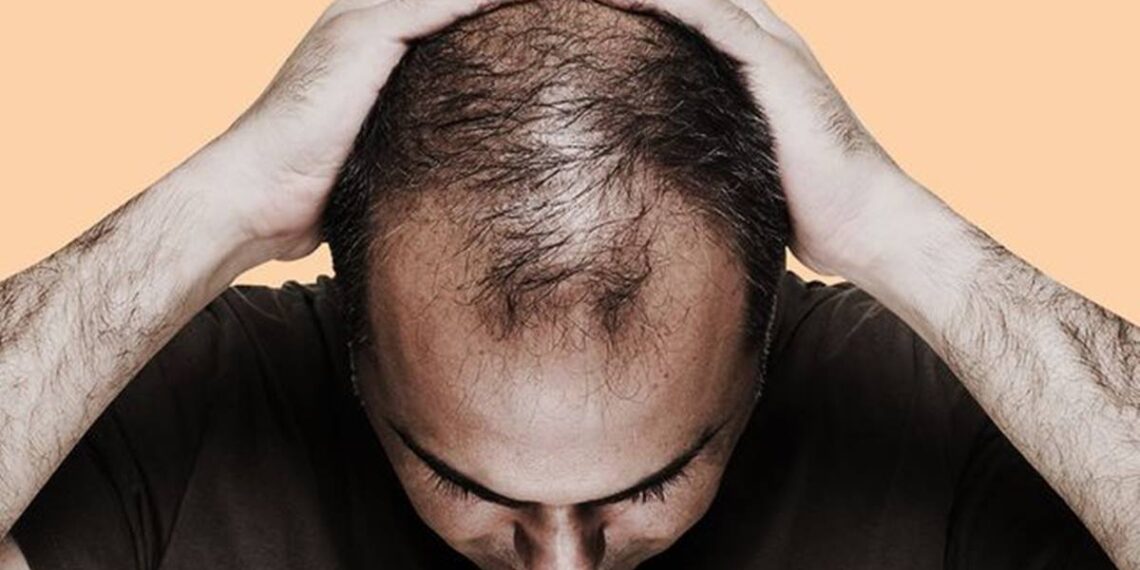 Foods that can accelerate hair fall