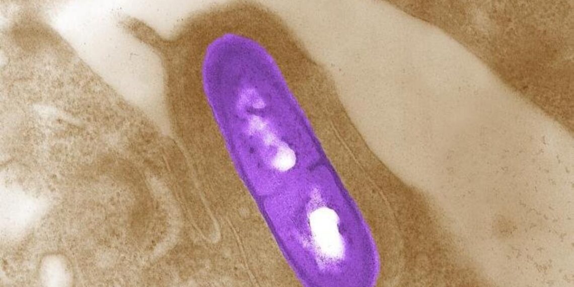 Costco, Trader Joe's and Walmart products made with cheese linked to deadly listeria outbreak