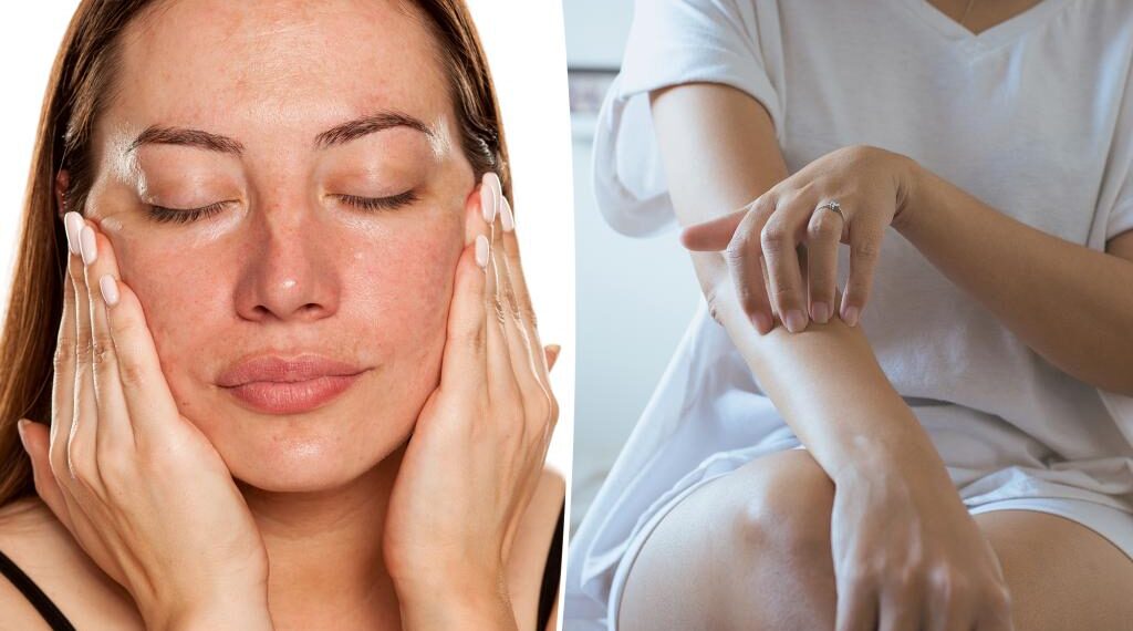 These are the foods that dehydrate your skin — and why you should 'eat' your water