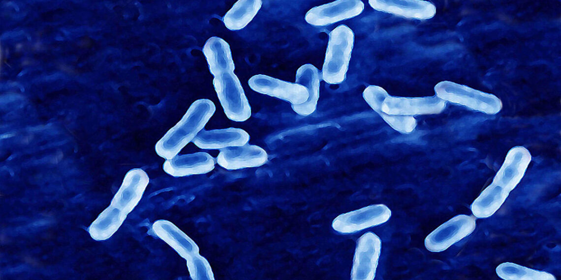 Rizo-López Foods cheese and dairy products recalled after deadly listeria outbreak