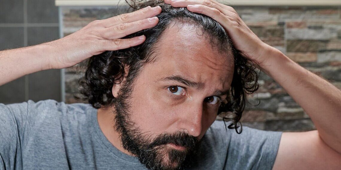 'I’m a health expert - here are 6 foods that prevent hair loss'