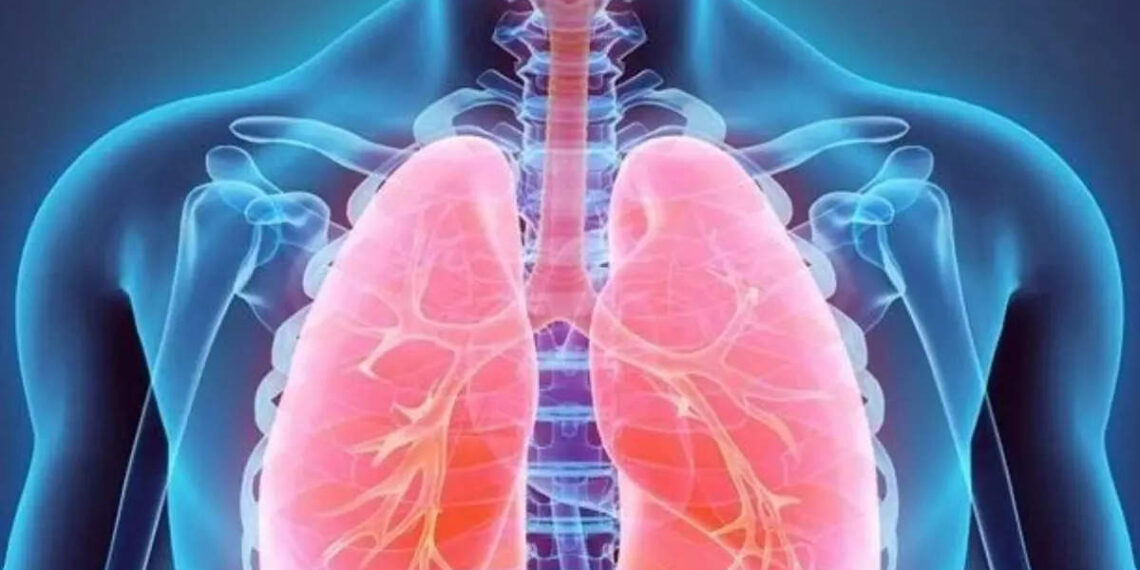 Diets high in ultra-processed foods raise death risk from chronic lung conditions, study finds, ET HealthWorld