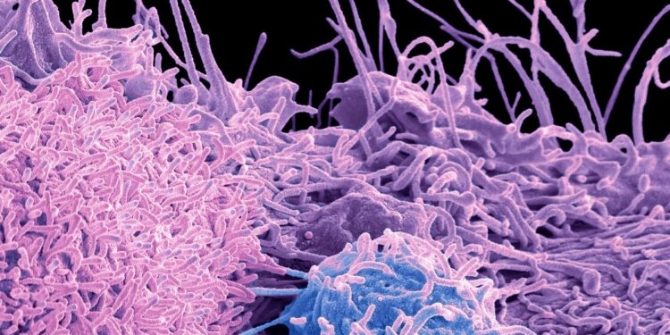 Doctor explains four foods to eat to prevent prostate cancer - and one to avoid