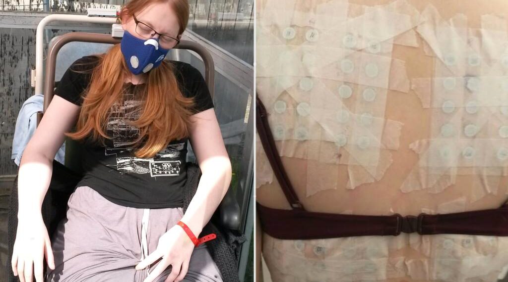 I was allergic to almost everything — it took years to find out why