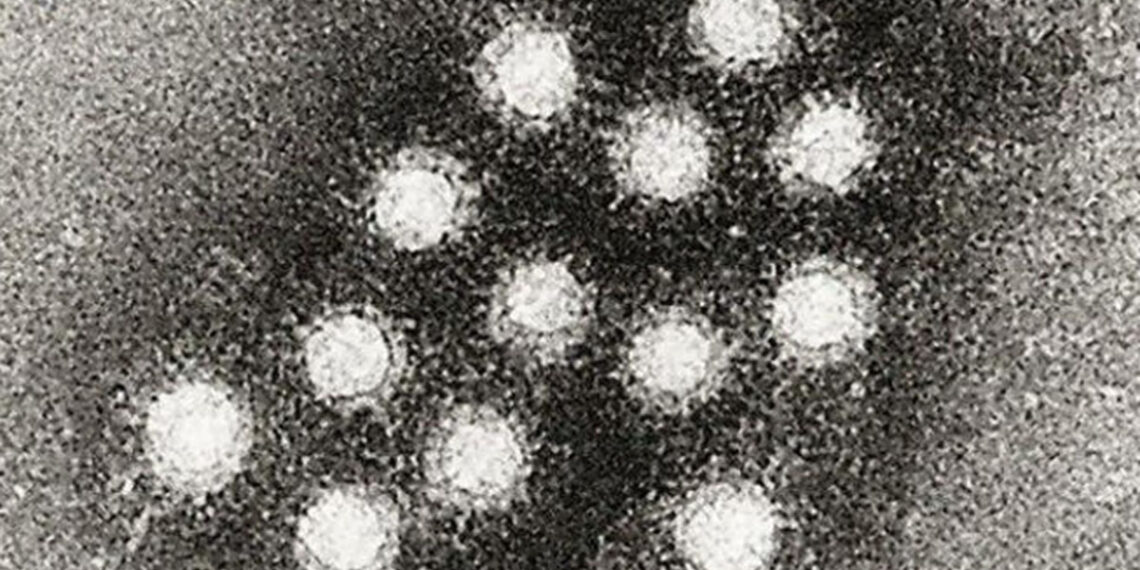 Beverly Hills Whole Foods worker tests positive for Hepatitis A – NBC Los Angeles