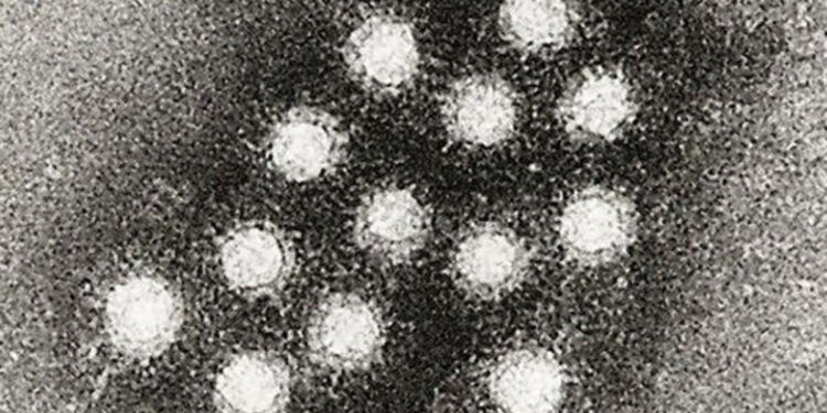 Beverly Hills Whole Foods worker tests positive for Hepatitis A – NBC Los Angeles