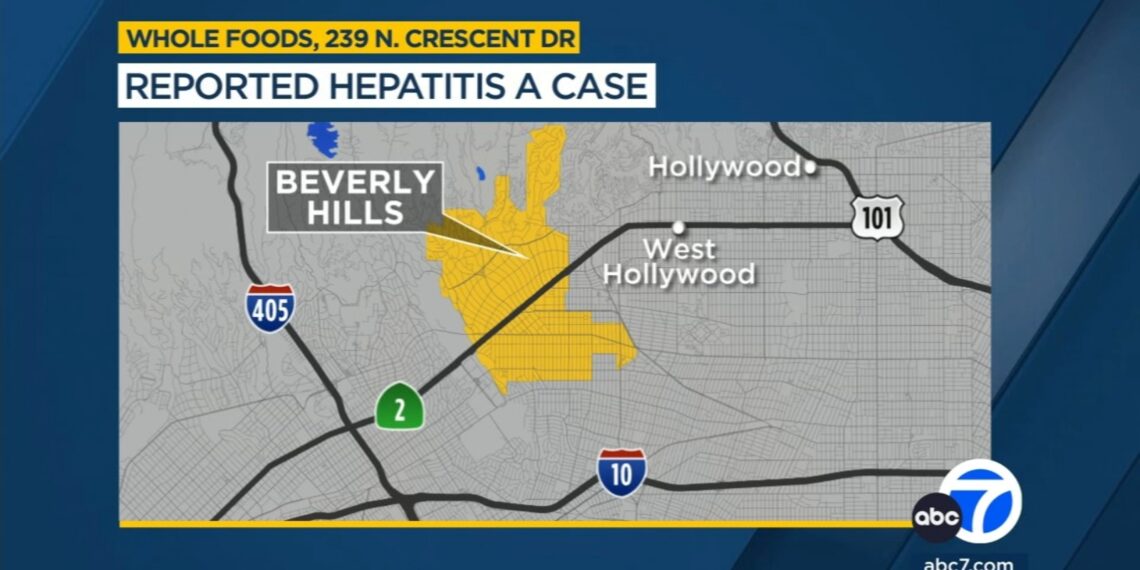 Hepatitis A infection reported in worker at Whole Foods in Beverly Hills