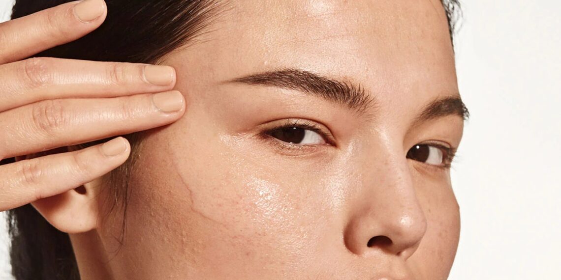 30 Best Acne Treatments of 2024, According to Dermatologists