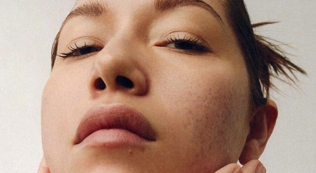 Your New Acne Skincare Routine, According to the Pros