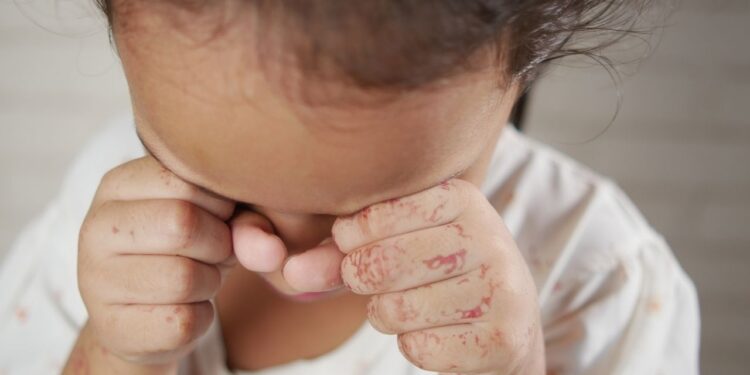 Piden atender con urgencia la trata de menores en cruceros de Monterrey