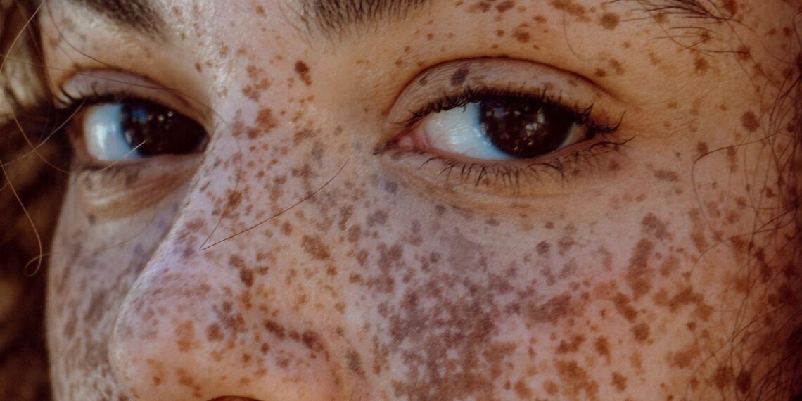 These Are the Best Radio Frequency Devices to Stimulate Collagen Production