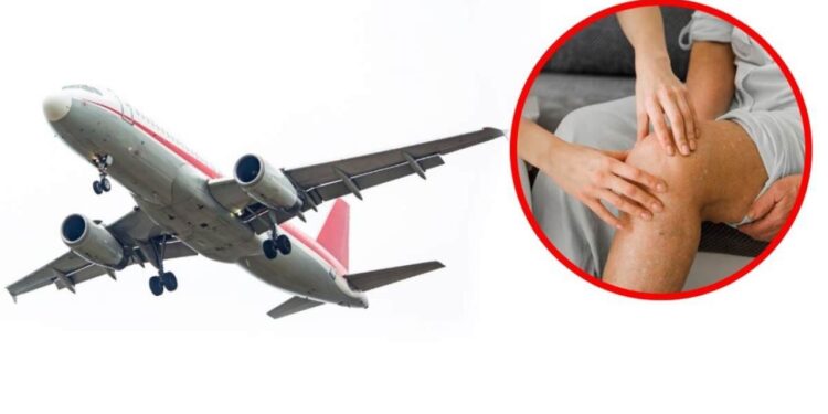 Alerta en el aire: La enfermedad silenciosa que amenaza tus viajes largos