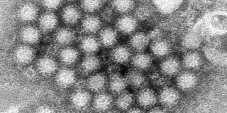 Altamente contagioso, transmisible y resistente: el trinomio que hace que el norovirus sea la pesadilla de los cruceros
