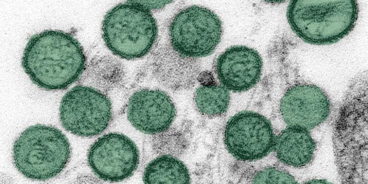 Brote de Hantavirus en crucero: otro pasajero contrae la enfermedad