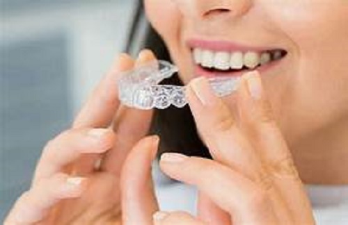 Más allá de lo invisible: la nueva era de los alineadores en belleza y salud dental