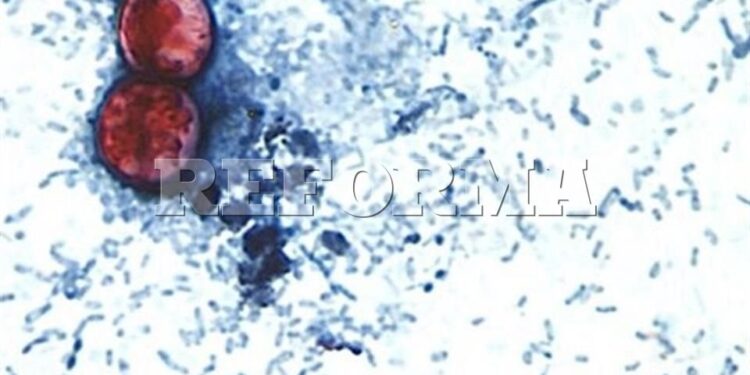 Alerta RU casos de ciclosporiasis ligados a viajes a México