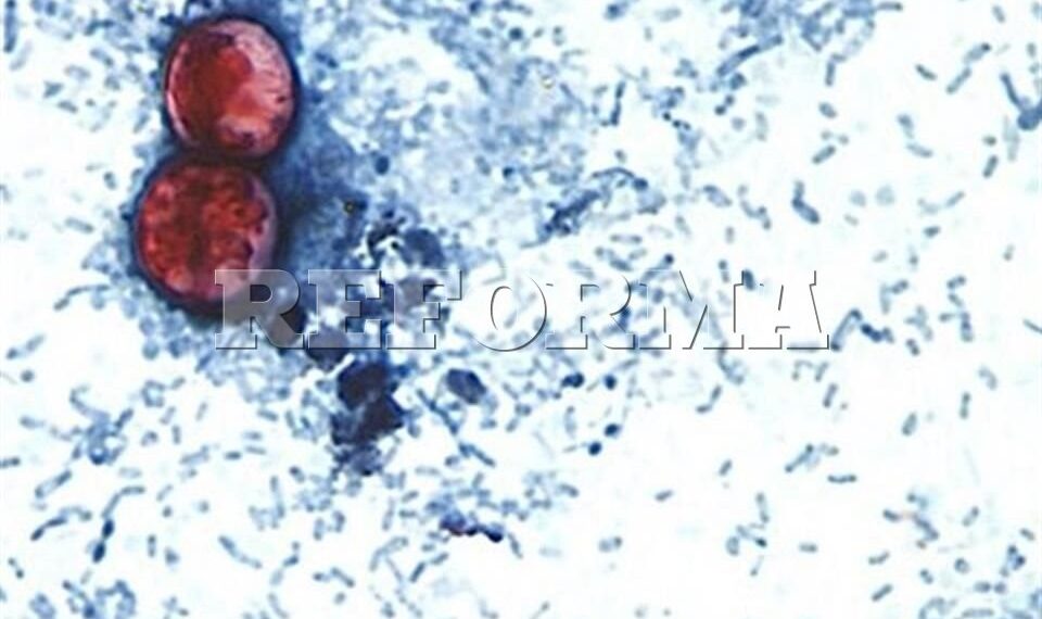 Alerta RU casos de ciclosporiasis ligados a viajes a México