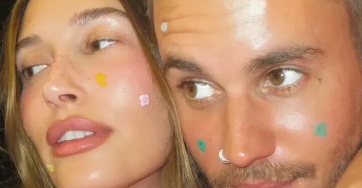 Hailey Bieber Is Healing Her Blisters With…Pimple Patches?