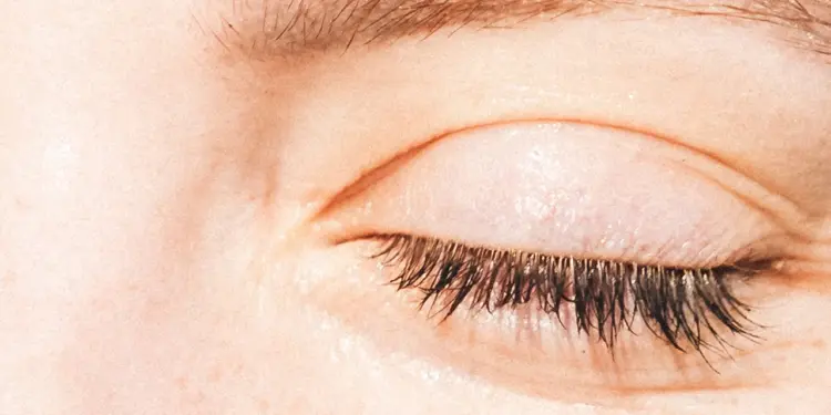 I Tried the Skin-Tightening XERF Treatment